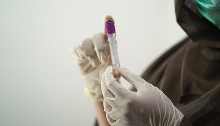 blood-test-5601437_1920