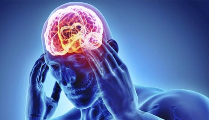 Epilepsia