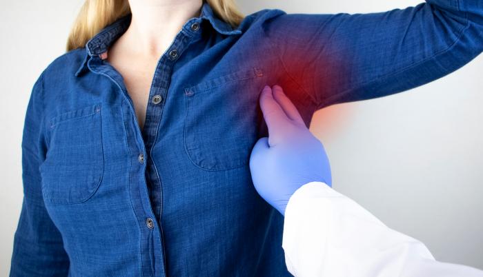 Ganglios linfáticos inflamados