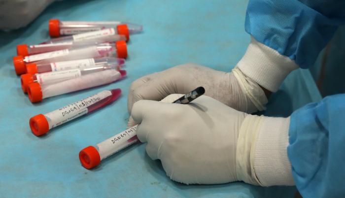 coronavirus