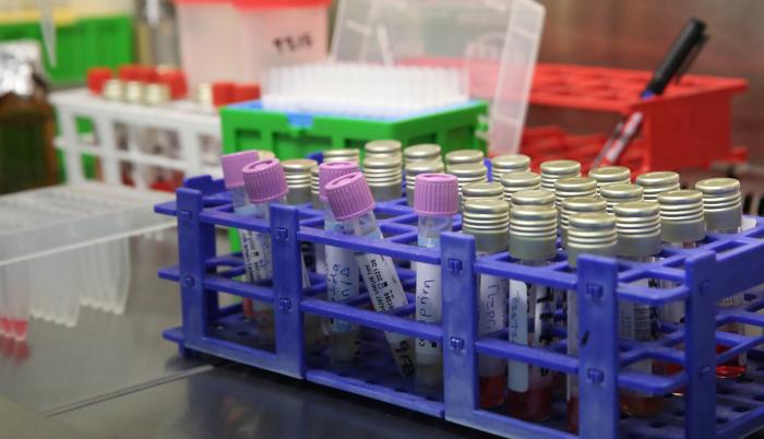Científicos españoles han logrado identificar las moléculas que consiguen frenar la entrada del coronavirus en las células, un descubrimiento que podría abrir la puerta para desarrollar fármacos antivirales eficaces contra el SARS-CoV-2 responsable de la