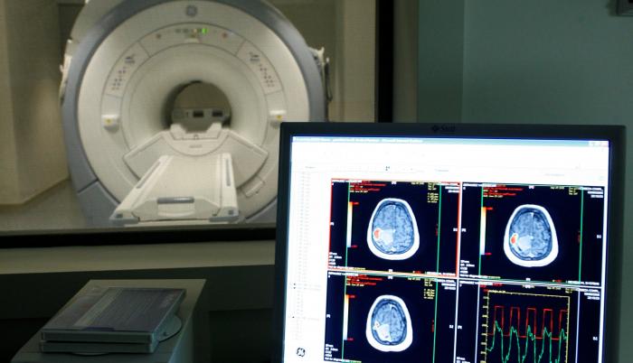 La enfermedad de alzhéimer es un trastorno neurodegenerativo que se caracteriza por el deterioro continuo de la memoria, el comportamiento y las habilidades sociales, lo que finalmente afecta la capacidad de una persona de vivir de manera independiente.