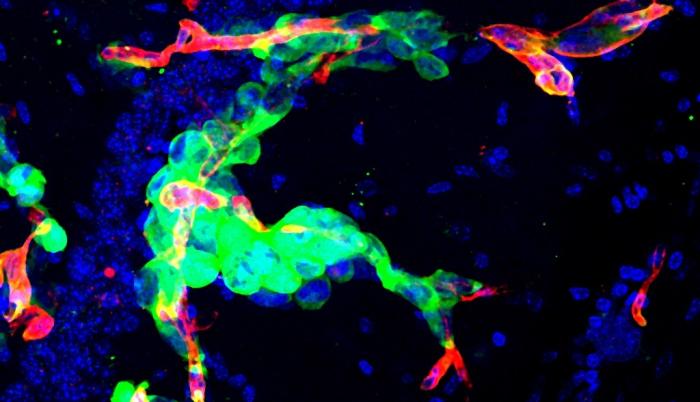 Imagen de la metástasis en cerebro de ratón cedida por el CNIO. En verde, células tumorales que permanecen ‘escondidas’ después de una cirugía y que actúan como potenciales semillas para la reaparición de la metástasis.
