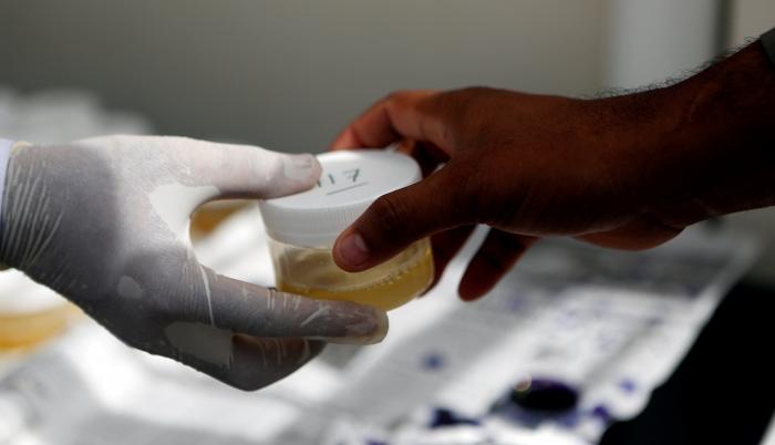 Un equipo científico de Brasil ha desarrollado un test capaz de detectar en la orina la presencia de anticuerpos contra el SARS-CoV-2 con una precisión comparable a las pruebas existentes basadas en suero sanguíneo.