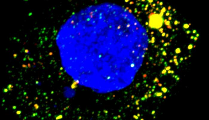 Imagen cedida de microscopía de fluorescencia de una célula hepática humana cultivada infectada por el virus de la hepatitis A.