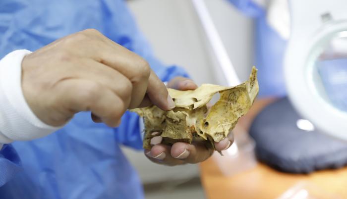 Los estudiantes de medicina de la Universidad de Guayaquil trabajan con cuerpos reales durante las prácticas de Anatomía.