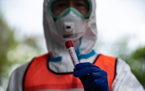 Un médico sostiene un recipiente utilizado para recolectar una muestra de un paciente durante una demostración de una prueba para el coronavirus COVID-19 en Fujisawa, suroeste de Tokio.