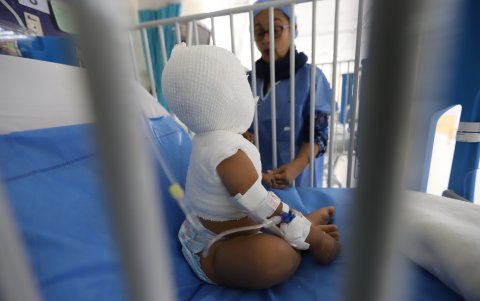 Niños quemados en el hospital Francisco Icaza Bustamante.
