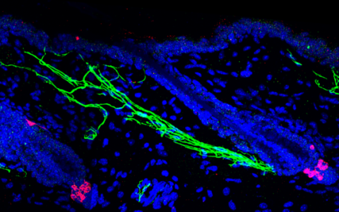 Inervación simpática (verde) alrededor de las células madre de los melanocitos (rojo).