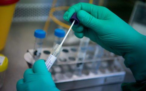 Un trabajador analiza una muestra de un caso sospechoso del nuevo Coronavirus 2019 en Stuttgart, Alemania.