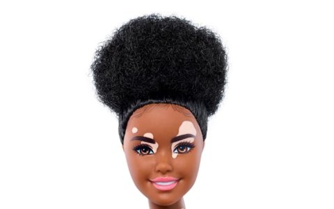 Barbie con vitiligio.