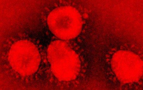 Imagen microscópica de un coronavirus.