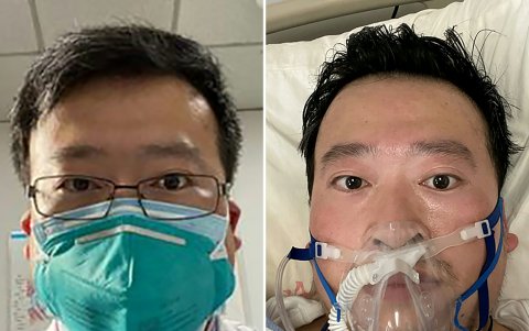Fotos sin fecha del médico denunciante de coronavirus chino,  Li Wenliang, antes y después de contagiarse de la enfermedad.