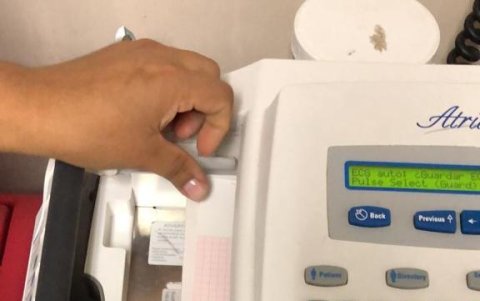 Listos los papeles para los electrocardiogramas.