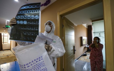 Un médico mira una imagen de tomografía computarizada en un hospital de Wuhan, epicentro del nuevo brote de coronavirus.