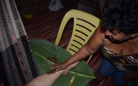 Aplicación. La mujer coloca la crema lodosa sobre la parte afectada