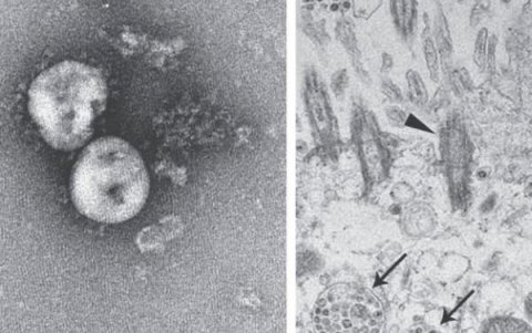 A la izquierda, el virus aislado, con sus picos proteicos que le sirven para adherirse a las células. A la derecha, ya en el interior de las células.