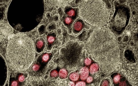 Captura del virus en células pulmonares.