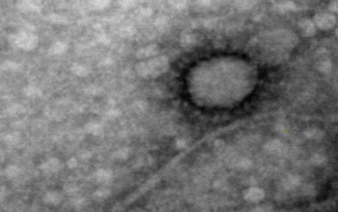 Los especialistas argentinos pudieron comparar sus estudios con el genoma identificado por científicos chinos.