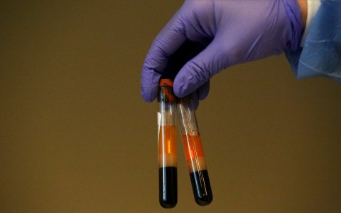 Muestras de personas que se hacen la prueba de anticuerpos contra el coronavirus en el Centro de Salud Refuah, en Nueva York.