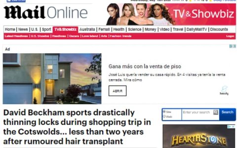 La imagen que le ha dado la vuelta al mundo. David Beckham luce con un severo problema capilar.