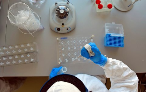 SANTIAGO. En Chile también hay laboratorios que están inmiscuidos en la búsqueda de una fórmula contra la COVID-19. Pero el proyecto se alargaría por lo menos dos años.