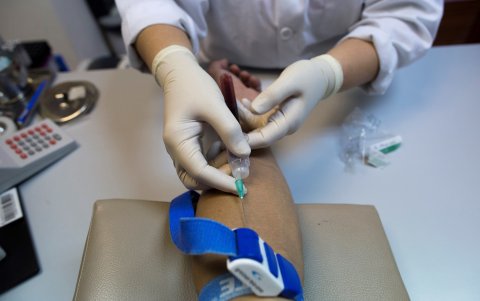 SAO PAULO. Hasta la fecha, solo dos personas se habían curado oficialmente de sida: Timothy Ray Brown, conocido como 'el paciente de Berlín' y Adam Castillejo, conocido como 'el paciente de Londres'.