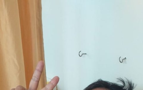 Recuperándose de la cirugía.