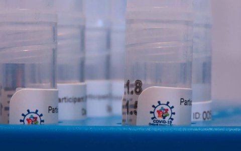 El prototipo de la vacuna de la Universidad de Oxford se basa en una versión debilitada del adenovirus.