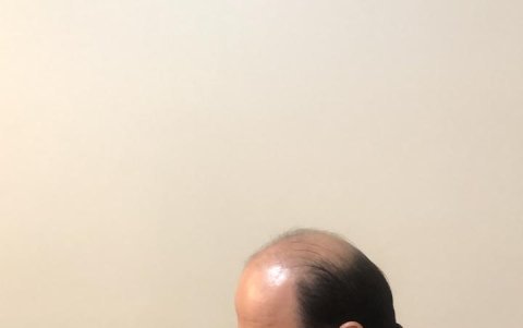 José Aguilar bebiendo una dosis de CDS.