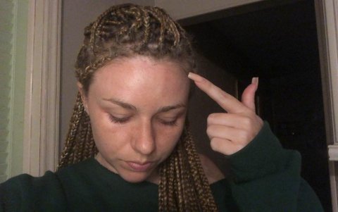 La presentadora y modelo tiene golpes en diferentes partes del cuerpo.