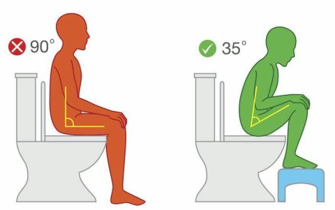 La forma incorrecta y la correcta de generar el ángulo de evacuación.
