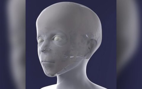 Proceso de reconstrucción computarizada del rostro en 3D del niño egipcio momificado.