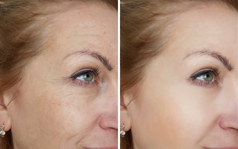 Antes y después del tratamiento estético.