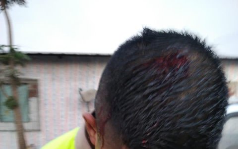 Los agentes resultaron con heridas en la cabeza y los brazos.