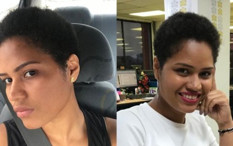 Proceso de crecimiento del nuevo cabello.