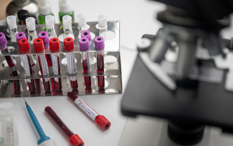 El ARNm es una molécula utilizada por las células vivas para convertir secuencias de genes del ADN en proteínas.