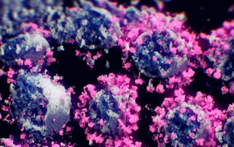 Los datos obtenidos se transforman en imágenes tridimensionales usando algoritmos.