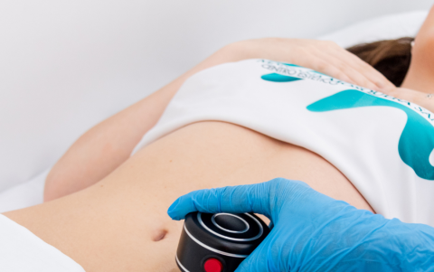 Tratamiento de radiofrecuencia.