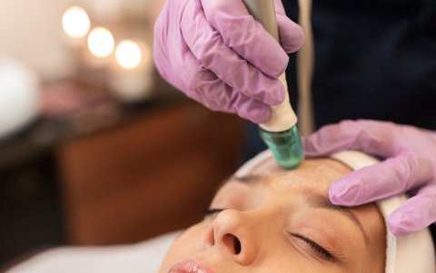 Tratamiento de microdermoabrasión