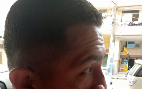 Agresión. Christian Tomalá muestra parte de las heridas que sufrió.