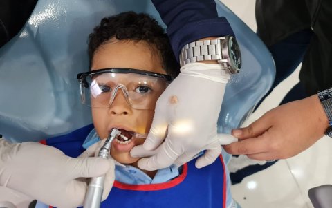 Limpieza dental en paciente menor.