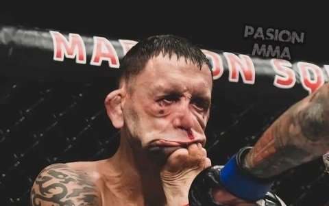 Así quedó el rostro de Frankie Edgar luego de la patada que le propinó el ecuatoriano.