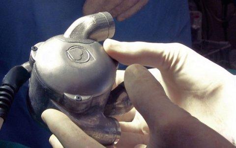 Bicavor, corazón biónico.