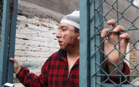 Recuperación. Steven Pazmiño dice que las heridas físicas se irán, pero cree que las generadas por la ausencia de sus amigos durarán más.