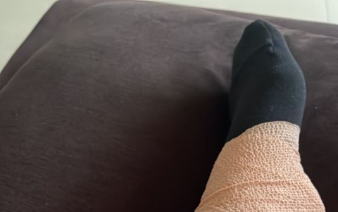 Dora West se accidentó.