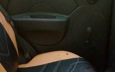 En este taxi, su conductor salió herido