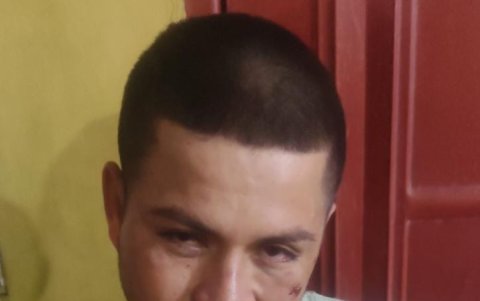 El individuo también sufrió leves lesiones tras estrellarse en el carro que había robado.