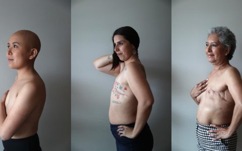 Combo de fotografías donde se observa a Lorena Estrada (i), Sandra Monrroy (c) y Angeles Arreola (d) pacientes con cáncer de mama, el 17 de octubre de 2022 en Ciudad de México (México).