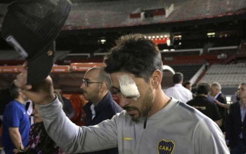 Pablo Pérez, capitán de Boca en 2018, apareció con venda en el ojo luego de sufrir con su equipo un ataque en el Barrio de Belgrano por hinchas de River.